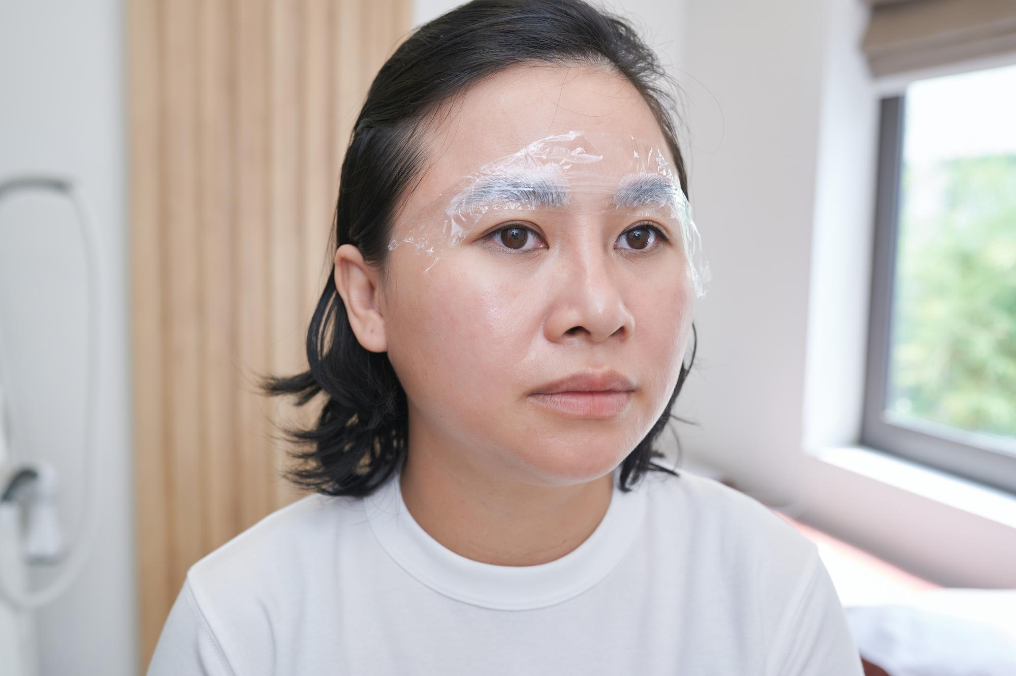 白斑不會傳染！別再用刺青遮了，醫師教你正確治療方式 — 時代熱搜健康深度報導
