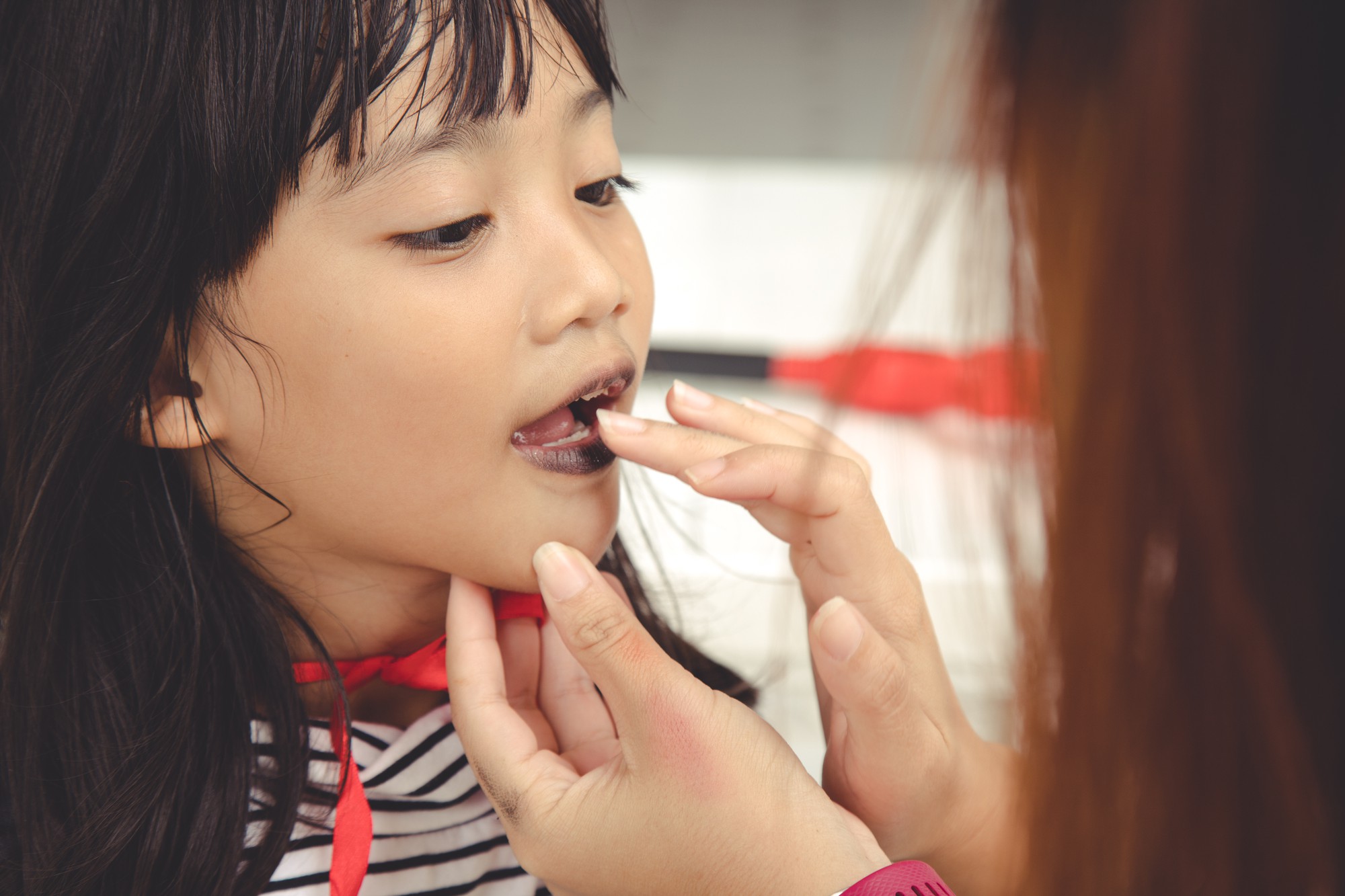 幼兒園最後一年的塗氟困境，終於要消失了